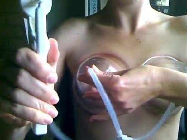 Breast Enlargement Pump Set - Image 5